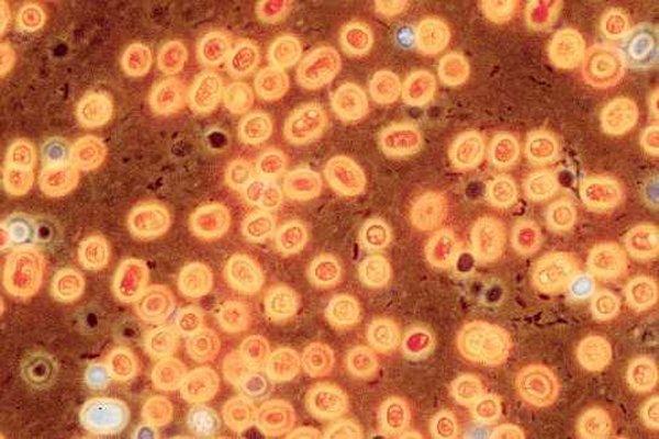 This colony of bacteria is typical of the myriads of one-celled creatures that make life as we know it possible on Earth | TNS