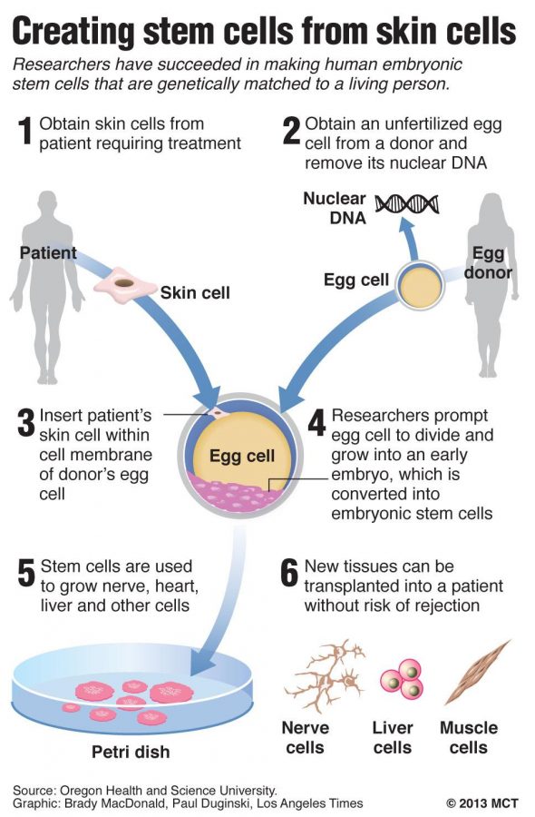 Graphic diagrams how researchers have created human stem cells from human skin cells; for the first time, scientists have created human embryos that are genetic copies of living people and used them to make stem cells. Los Angeles Times/MCT