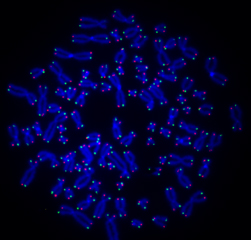 A new cancer study showed how cancer cells, in blue, trick the telomeres, in red and green, to stop shortening, meaning the cancer cells, continue to multiply. | Courtesy of Roderick O’Sullivan