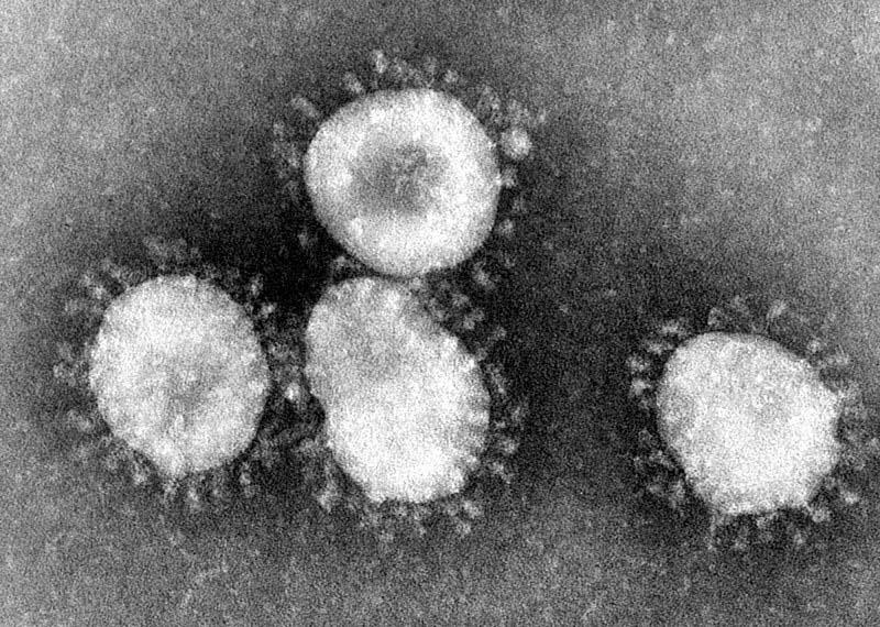 Pitt announced it is reviewing its pandemic preparedness plan, which includes setting up a centralized website for reliable updates about the SARS-CoV-2 coronavirus. 
