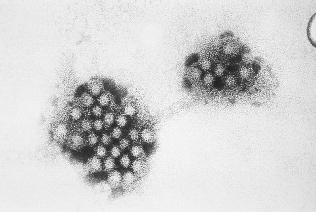 An+electron+micrograph+of+the+norovirus.